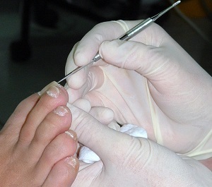 Pedicure Praktijk Liesbeth - Hoofddorp