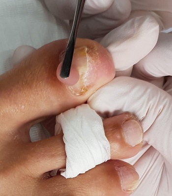 Lenkunya Pedi Medisch Pedicurepraktijk - Nieuwerbrug aan den Rijn