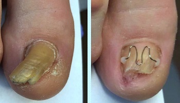 Medisch Pedicure Praktijk Pedicare Noordwijk