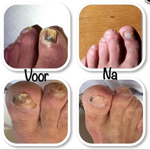 Pedicure Praktijk Voet Fit - Rolde