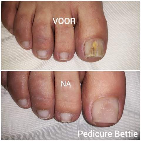 Pedicure Bettie - Goor