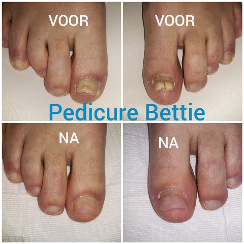 Pedicure Bettie - Goor