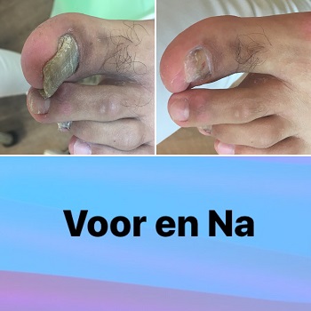 Pedicure Praktijk Feet in Shape - Enschede