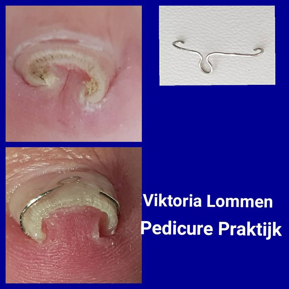 Arkada Pedicure Viktoria Lommen - Geleen