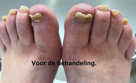 Medisch Pedicure Only4U - Enschede