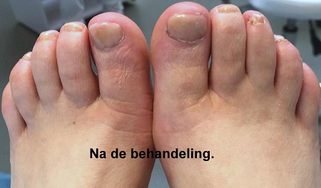 Medisch Pedicure Only4U - Enschede