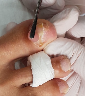 Pedicure Voetenzorg Hennie - Breda