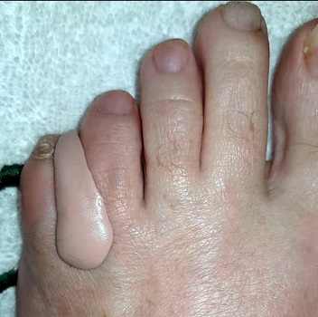 Birke Steen Medisch Pedicure - Bergen