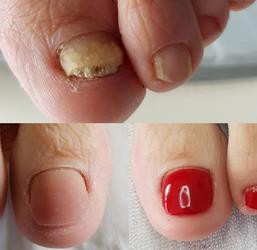 Medisch Pedicure Salon Miranda - Spijkenisse