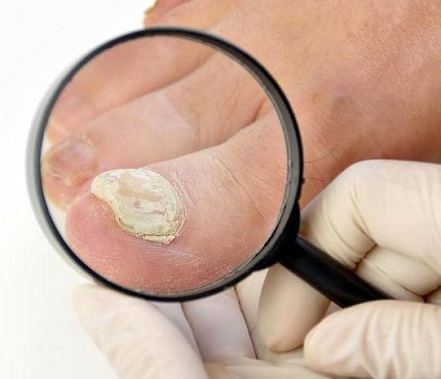 Tina Nijstad Podologie en Medisch Pedicure - Hoogeveen