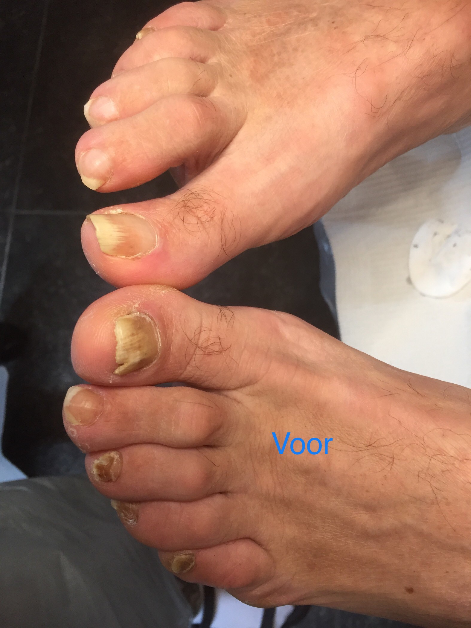 Pedicurepraktijk Pedi-Elle - Enter