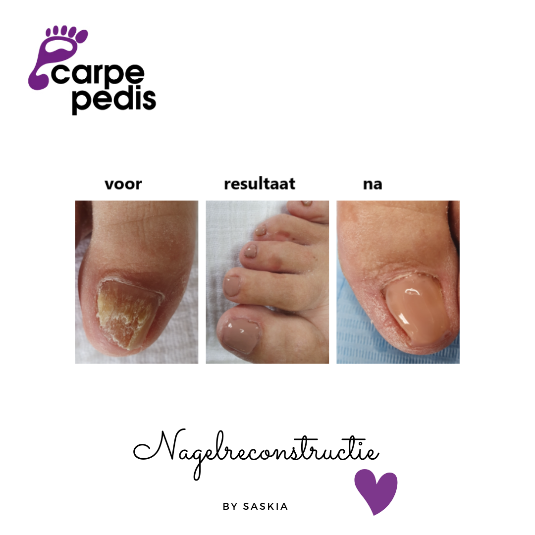 Carpe Pedis, Reflexologie / Medisch Pedicure - Warnsveld