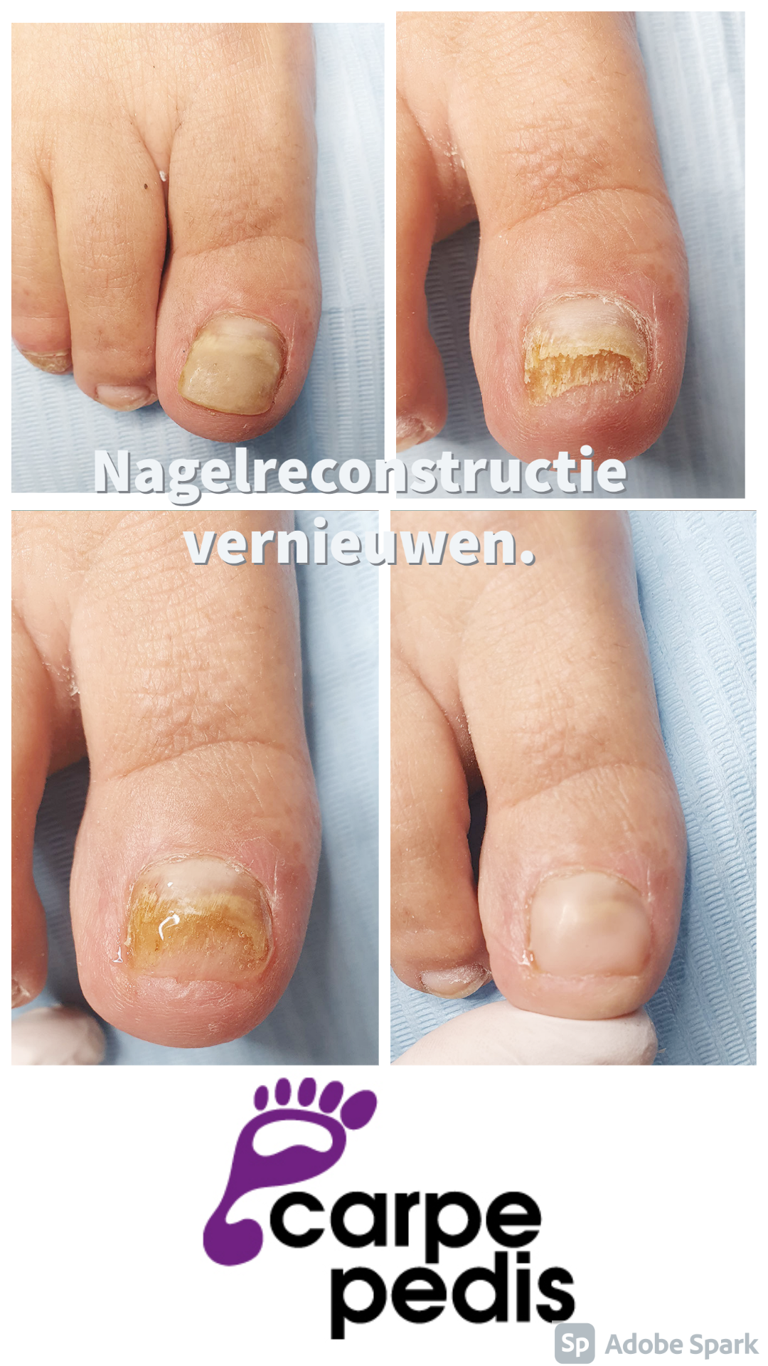 Carpe Pedis, Reflexologie / Medisch Pedicure - Warnsveld