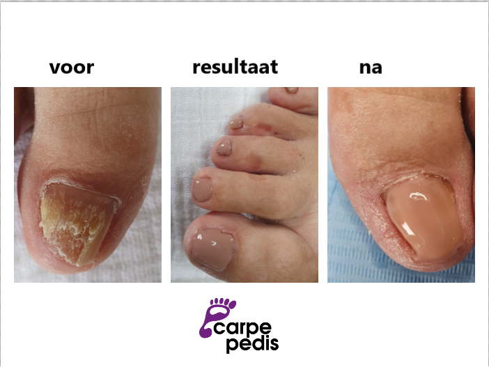 Carpe Pedis, Reflexologie / Medisch Pedicure - Warnsveld