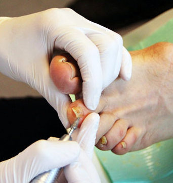 Pedicure Elvira de Vries Voetverzorging - Deventer