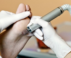 Pedicure -Bovensmilde