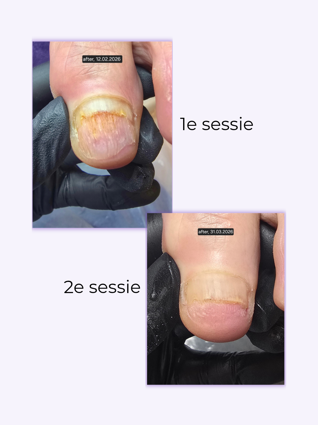 SuuCure - gespecialiseerde pedicure & nagelstyling in Enschede