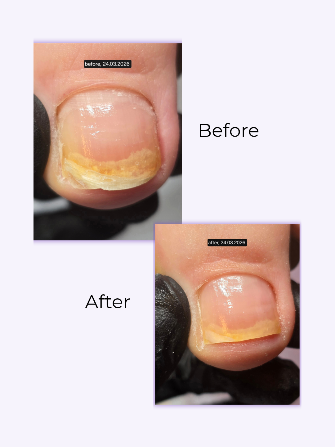 SuuCure - gespecialiseerde pedicure & nagelstyling in Enschede