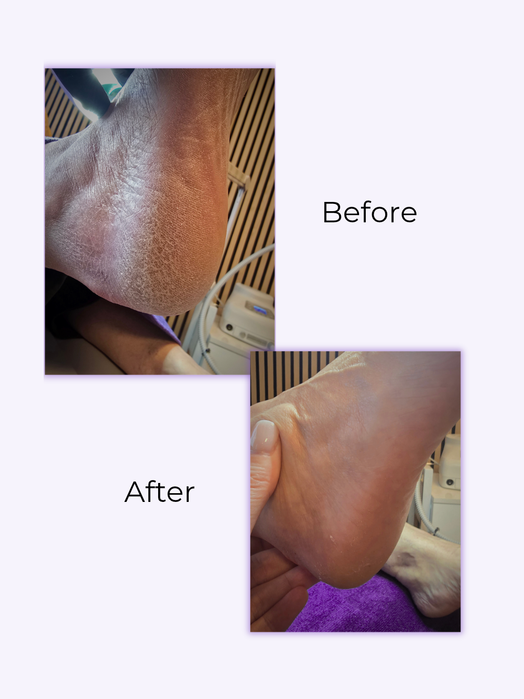 SuuCure - gespecialiseerde pedicure & nagelstyling in Enschede