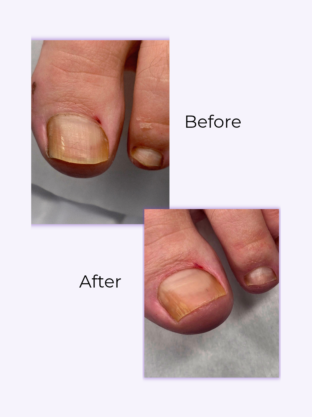 SuuCure - gespecialiseerde pedicure & nagelstyling in Enschede