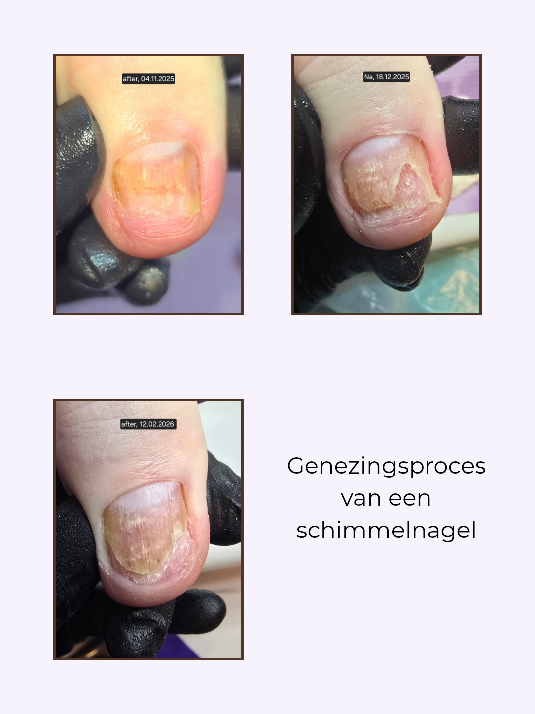SuuCure - gespecialiseerde pedicure & nagelstyling in Enschede